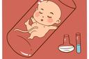 多囊卵巢做成都三代试管婴儿成功率高吗?